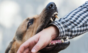 Dog bite injury - Coker Law Personal Injury Lawyers - Dog bite lawyers in Jacksonville near me.